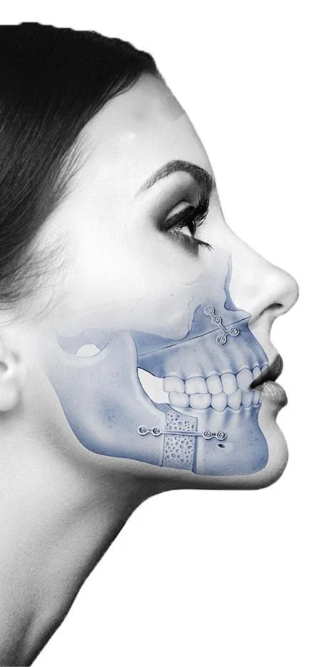 Maxillofacial Surgery-denthetics